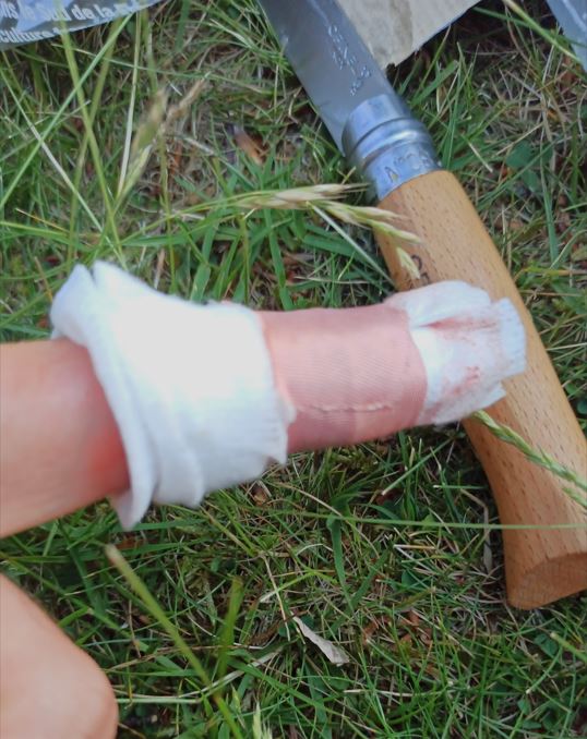 la blessure bete sur un trek : le couteau qui ripe sur le doigt. trousse de secours utile !